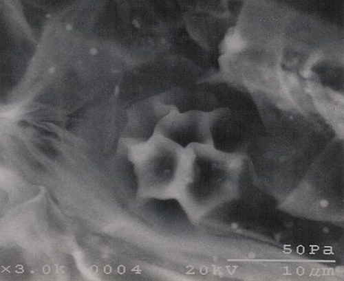A resting spore of Olpisium sp.