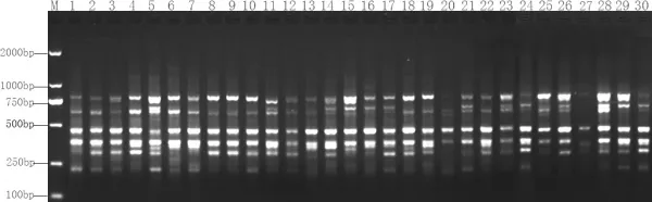 ISSR profiles ISSR profiles