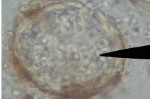 Trichoderma, Phoma 