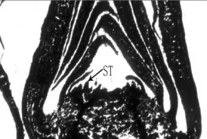 Fig1I
