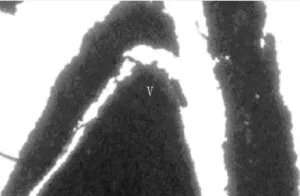 Fig1A