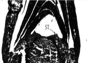 Fig1H