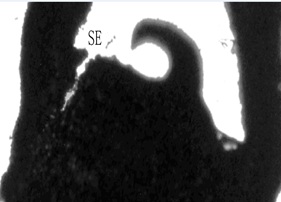 Fig1E